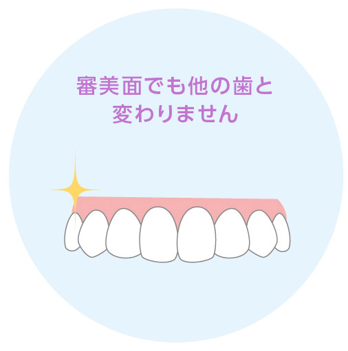 インプラント